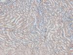 Phospho-ErbB2 (HER-2) (Thr686) Antibody in Immunohistochemistry (Paraffin) (IHC (P))