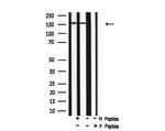 Phospho-ErbB2 (HER-2) (Thr686) Antibody in Western Blot (WB)