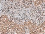 Phospho-ErbB3 (Tyr1328) Antibody in Immunohistochemistry (Paraffin) (IHC (P))