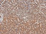 Phospho-ErbB3 (Tyr1328) Antibody in Immunohistochemistry (Paraffin) (IHC (P))