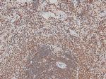 Phospho-ErbB3 (Tyr1328) Antibody in Immunohistochemistry (Paraffin) (IHC (P))