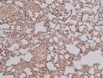 Phospho-PDGFRA (Tyr762) Antibody in Immunohistochemistry (Paraffin) (IHC (P))