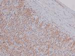 Phospho-PDGFRA (Tyr762) Antibody in Immunohistochemistry (Paraffin) (IHC (P))