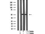 Phospho-PPAR alpha (Ser21) Antibody in Western Blot (WB)