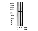 Phospho-SMAD1 (Ser214) Antibody in Western Blot (WB)