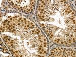 Phospho-SMAD2 (Ser255) Antibody in Immunohistochemistry (Paraffin) (IHC (P))