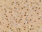 Phospho-SMAD2 (Ser255) Antibody in Immunohistochemistry (Paraffin) (IHC (P))