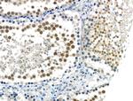 Phospho-SMAD2 (Ser255) Antibody in Immunohistochemistry (Paraffin) (IHC (P))