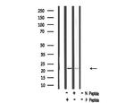 Phospho-HAND1 (Ser98) Antibody in Western Blot (WB)