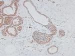 Phospho-HIC5 (Tyr60) Antibody in Immunohistochemistry (Paraffin) (IHC (P))