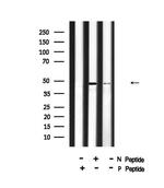 Phospho-HIC5 (Tyr60) Antibody in Western Blot (WB)