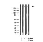 Phospho-IGF2R (Ser2484) Antibody in Western Blot (WB)