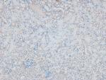 Phospho-ITGA4 (Ser1027) Antibody in Immunohistochemistry (Paraffin) (IHC (P))