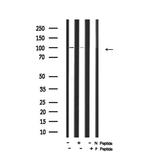 Phospho-ITGA4 (Ser1027) Antibody in Western Blot (WB)