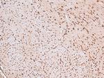 Phospho-MARK Pan (Thr215) Antibody in Immunohistochemistry (Paraffin) (IHC (P))