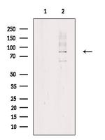 Phospho-MARK2 (Thr596) Antibody in Western Blot (WB)