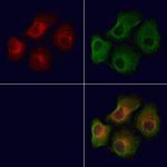 Phospho-MARK2 (Thr596) Antibody in Immunocytochemistry (ICC/IF)