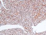 Phospho-MLK3 (Thr277, Ser281) Antibody in Immunohistochemistry (Paraffin) (IHC (P))