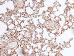 Phospho-MLK3 (Thr277, Ser281) Antibody in Immunohistochemistry (Paraffin) (IHC (P))