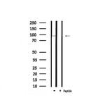 Phospho-MLK3 (Thr277, Ser281) Antibody in Western Blot (WB)