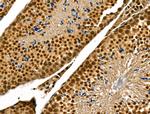 Phospho-p300 (Ser1834) Antibody in Immunohistochemistry (Paraffin) (IHC (P))