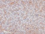 Phospho-KIF1C (Ser1092) Antibody in Immunohistochemistry (Paraffin) (IHC (P))