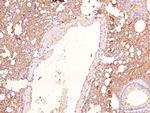 Phospho-KIF1C (Ser1092) Antibody in Immunohistochemistry (Paraffin) (IHC (P))