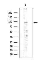 Phospho-PKD2 (Ser812) Antibody in Western Blot (WB)