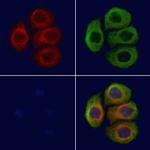 Phospho-VAMP4 (Ser30) Antibody in Immunocytochemistry (ICC/IF)