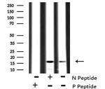 Phospho-VAMP4 (Ser30) Antibody in Western Blot (WB)