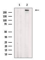 Phospho-ATM (Ser367) Antibody in Western Blot (WB)