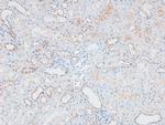 Phospho-ATM (Ser1893) Antibody in Immunohistochemistry (Paraffin) (IHC (P))