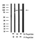 Phospho-beta Catenin (Ser675) Antibody in Western Blot (WB)