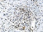 Phospho-CREB (Ser111) Antibody in Immunohistochemistry (Paraffin) (IHC (P))