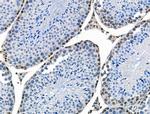 Phospho-CREB (Ser111) Antibody in Immunohistochemistry (Paraffin) (IHC (P))