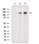 Phospho-EGFR (Tyr998) Antibody in Western Blot (WB)