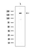 Phospho-EGFR (Tyr998) Antibody in Western Blot (WB)