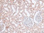 Phospho-EGFR (Tyr998) Antibody in Immunohistochemistry (Paraffin) (IHC (P))