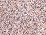 Phospho-EGFR (Tyr998) Antibody in Immunohistochemistry (Paraffin) (IHC (P))