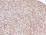 Phospho-EGFR (Tyr998) Antibody in Immunohistochemistry (Paraffin) (IHC (P))