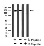 Phospho-eNOS (Ser633) Antibody in Western Blot (WB)