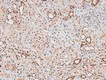 Phospho-FAK (Tyr577) Antibody in Immunohistochemistry (Paraffin) (IHC (P))