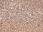 Phospho-FAK (Tyr577) Antibody in Immunohistochemistry (Paraffin) (IHC (P))