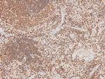 Phospho-FAK (Tyr577) Antibody in Immunohistochemistry (Paraffin) (IHC (P))