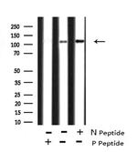 Phospho-FAK (Tyr577) Antibody in Western Blot (WB)