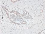 Phospho-FOXO3A (Ser315) Antibody in Immunohistochemistry (Paraffin) (IHC (P))