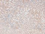 Phospho-FOXO3A (Ser315) Antibody in Immunohistochemistry (Paraffin) (IHC (P))