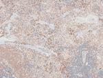 Phospho-FOXO3A (Ser315) Antibody in Immunohistochemistry (Paraffin) (IHC (P))