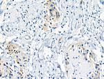 Phospho-IGF1R (Tyr980) Antibody in Immunohistochemistry (Paraffin) (IHC (P))