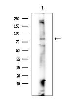 Phospho-IGF1R (Tyr980) Antibody in Western Blot (WB)